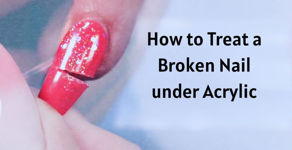 How to Treat a Broken Nail under Acrylic