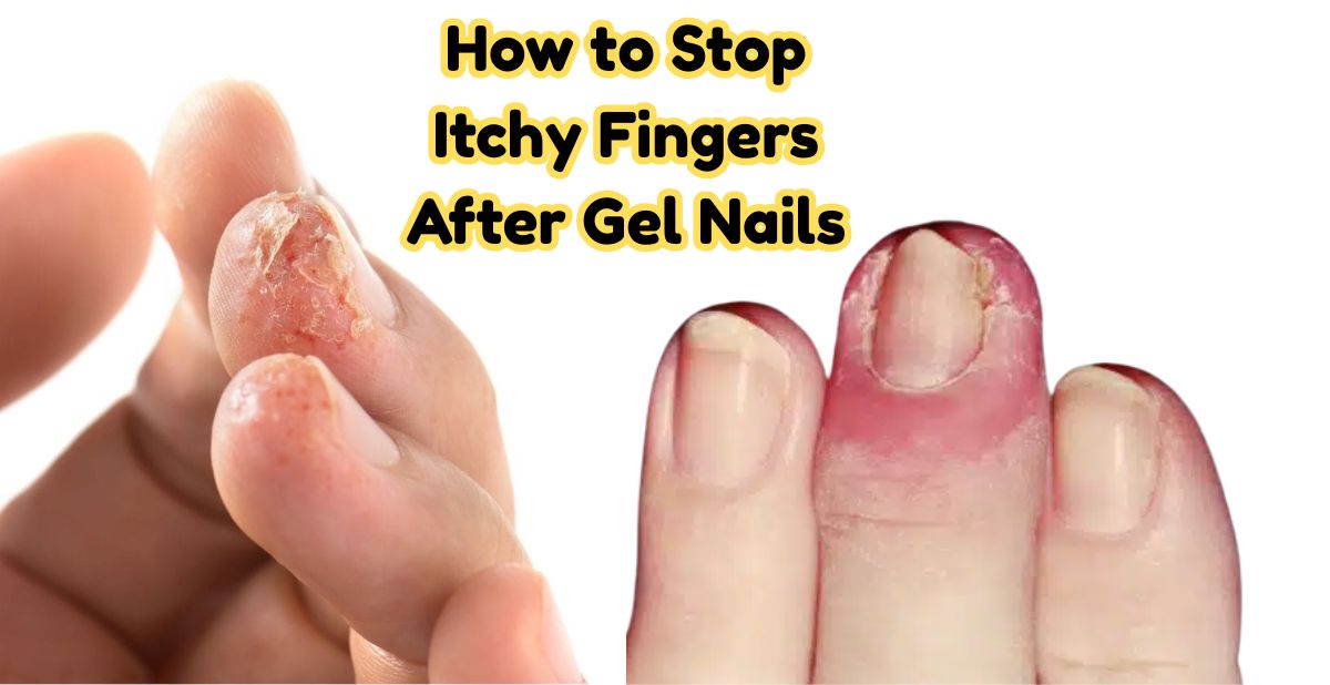 How-to-Stop-Itchy-Fingers-After-Gel-Nails