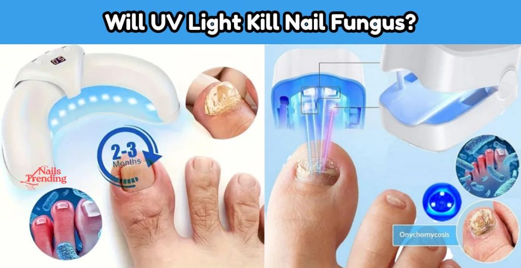 Nail Fungus