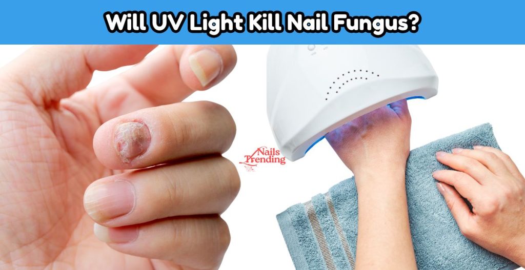 Will UV Light Kill Nail Fungus 