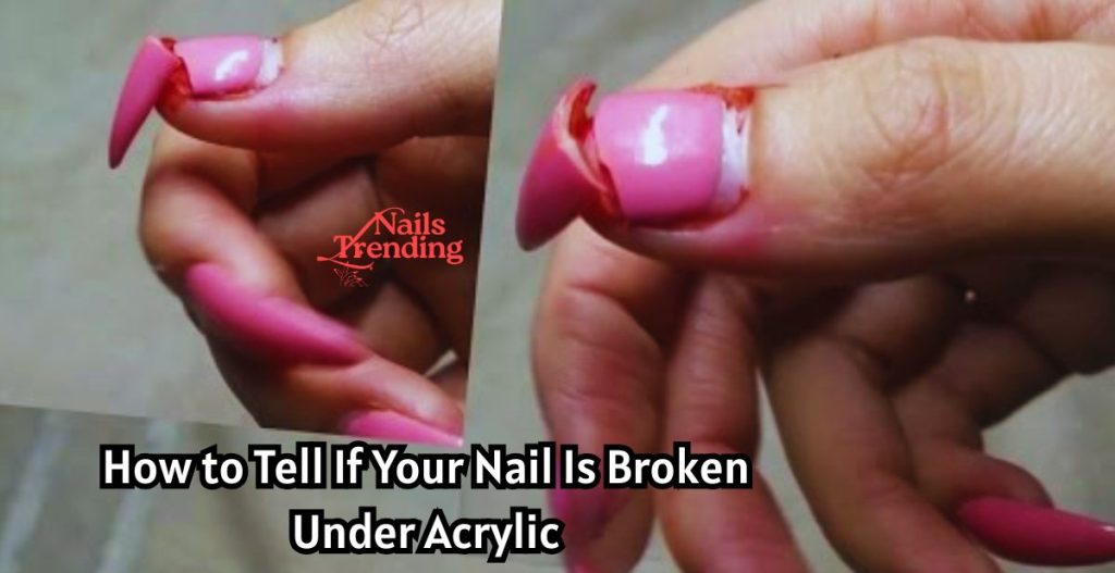 How to Tell If Your Nail Is Broken Under Acrylic