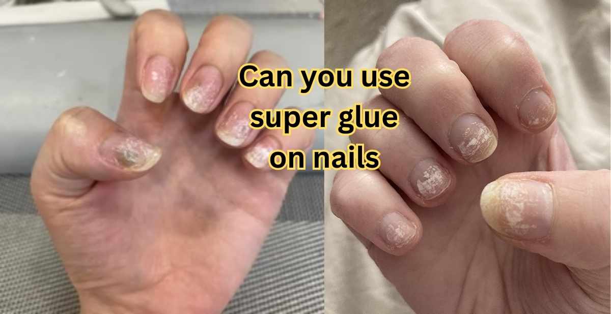 Can you use super glue on nails