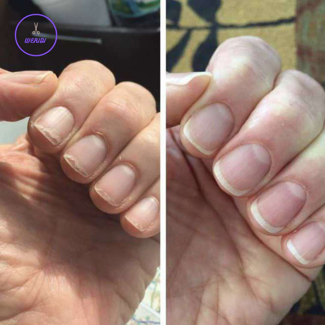 How To Stop Nails From Peeling