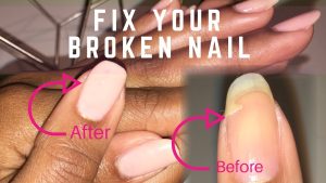 How To Fix A Broken Nail