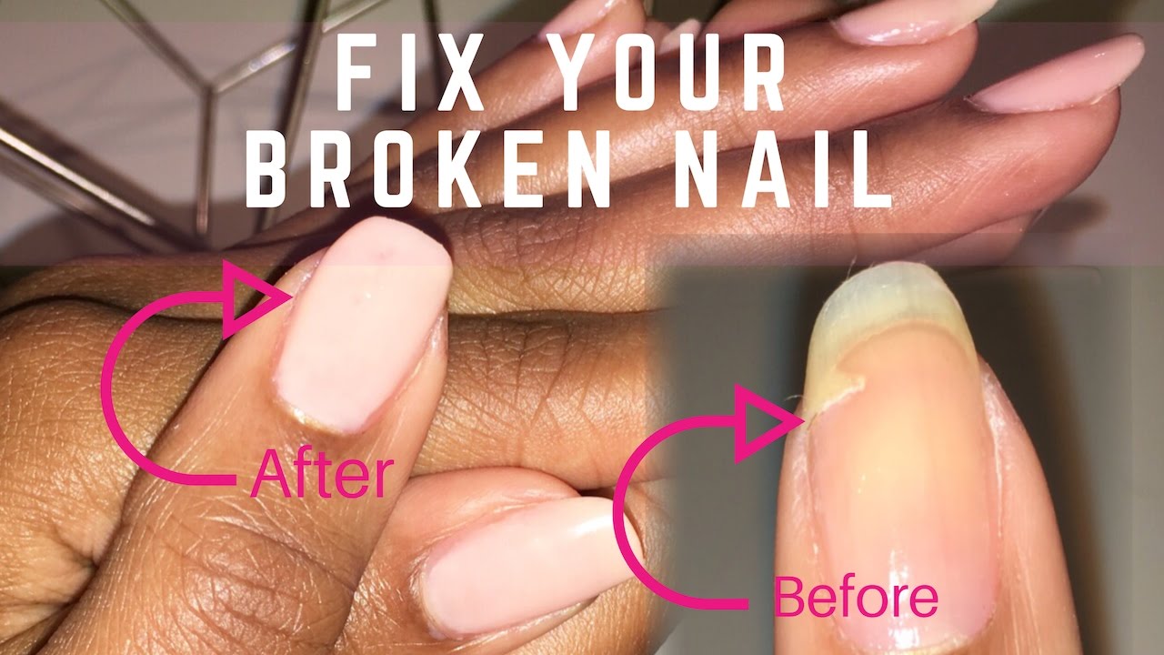 How To Fix A Broken Nail