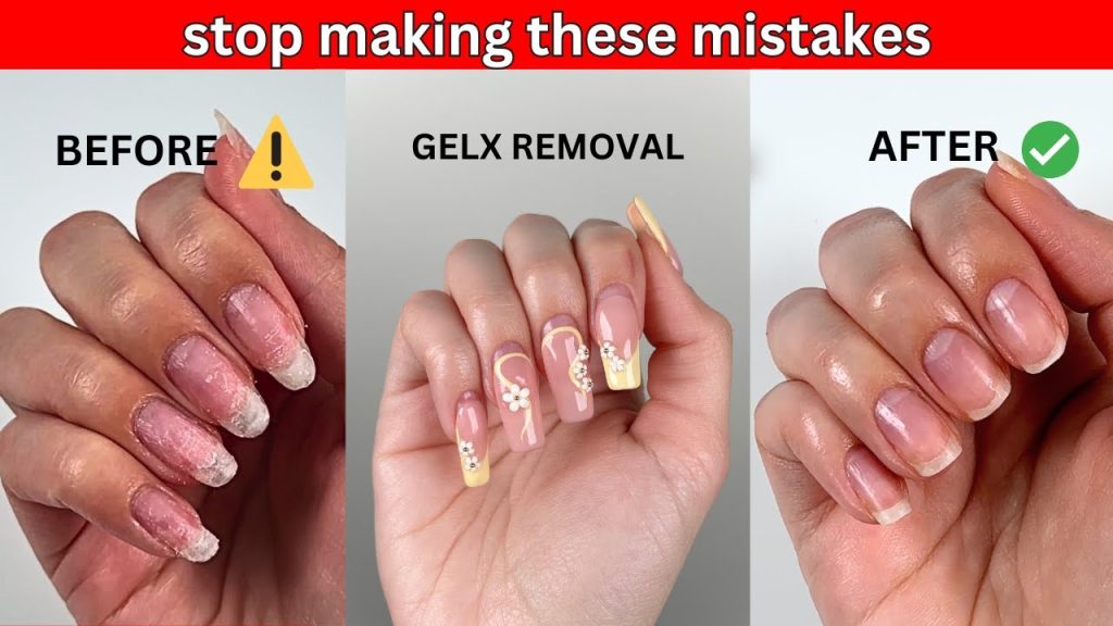 How To Repair Nails After Gel Manicure Damage