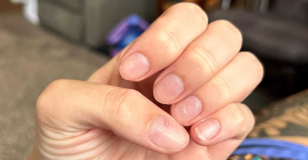 How To Strengthen Your Nails After Acrylics